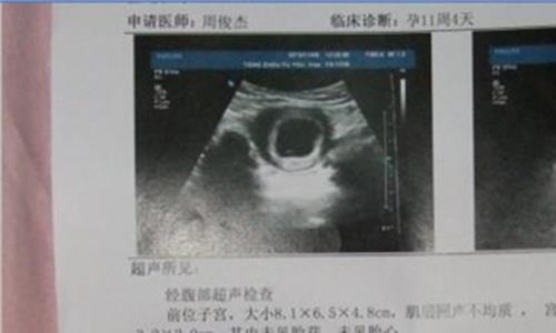连云港第三代赠卵试管婴儿哪家好？